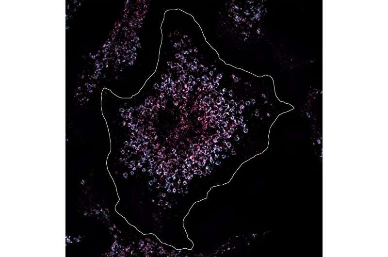Researchers trace a form of lupus back to a single mutation